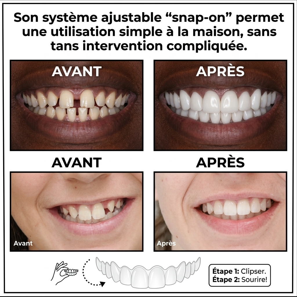 Prothèse Anti-Dents Cassées